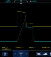 汽车示波器检测汽车喷油嘴(汽油机)信号波形